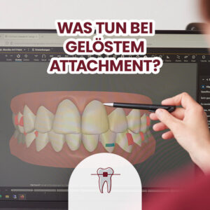 Alignerbehandlung, Bildschirm, Attachments, Erläuterung von Dr. Gedigk